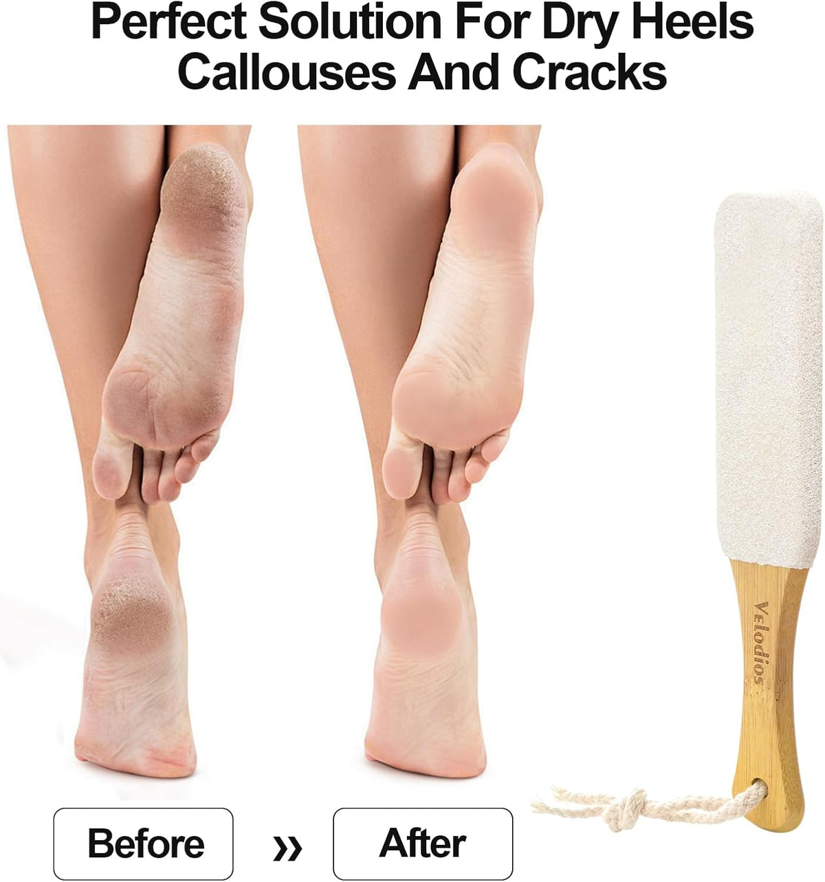 Pumice Stone for Feet Callus Remover | 2 Pack Professional Foot Scrubber Remove Cracked Heels,Dead Skin,Corn,Scraper File Foot Care Foot Rasp for Men/Women